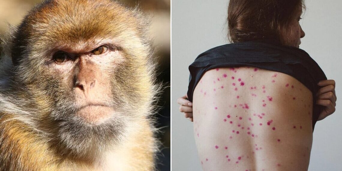 Augmenten els casos de virola del mico: l'OMS declara emergència sanitària